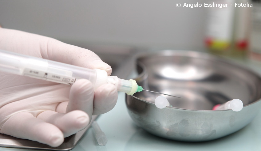 Vor Arbeitsbeginn Blutentnahme: Ein HIV-Test gehört teilweise noch immer zur Einstellungsuntersuchung